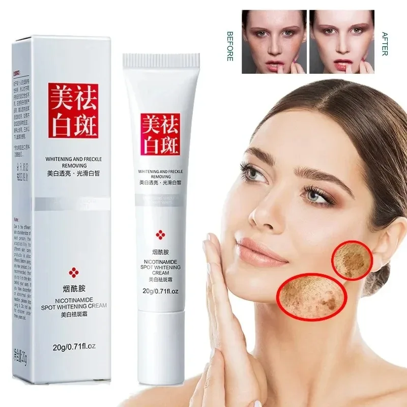 Charcoal Whitening Paste - يتلاشى النمش البقع الداكنة كريم وجه