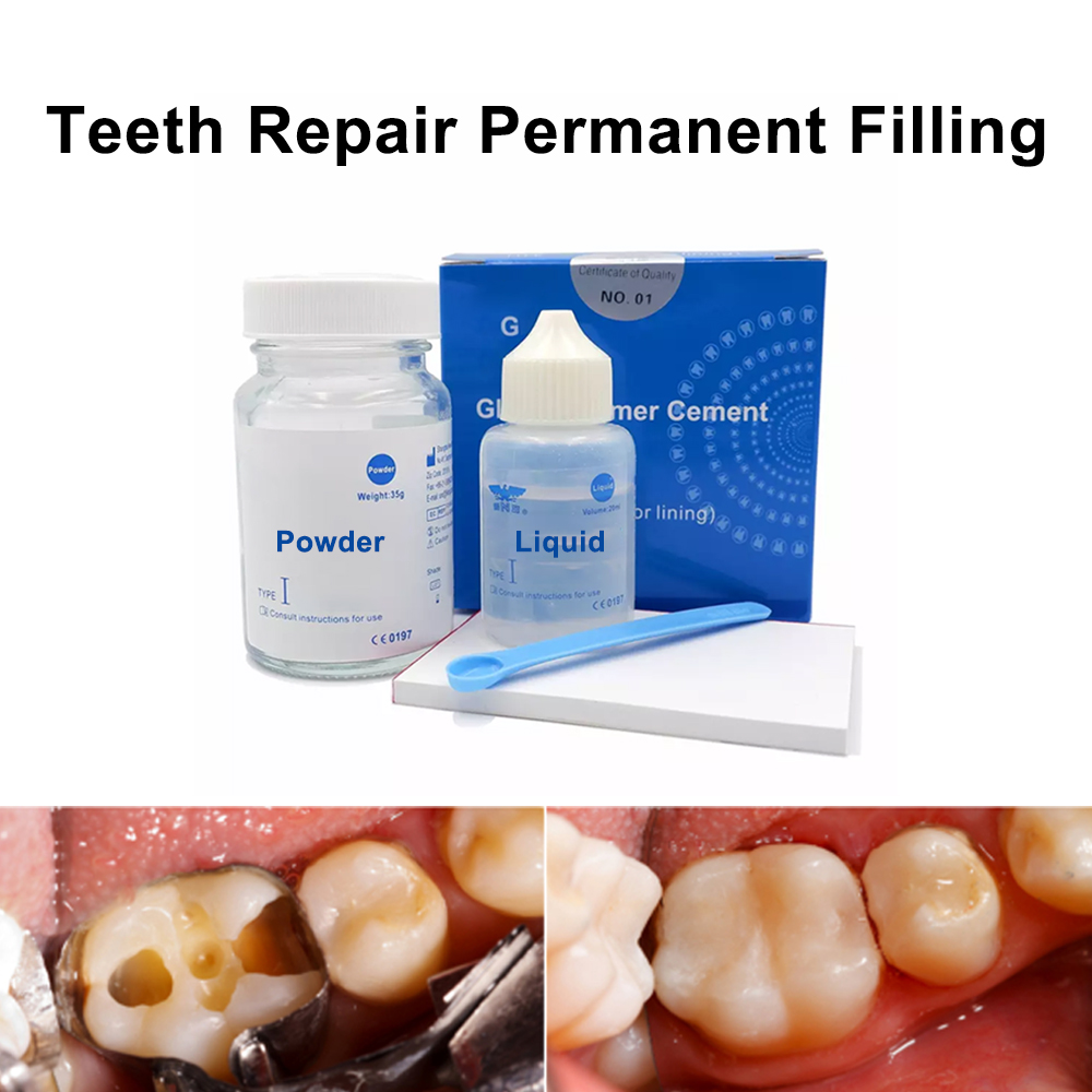 Teeth Whitening Kit At Home - دائم الأسنان ملء طقم إصلاح في