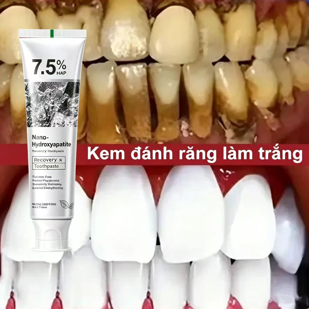 Teeth Whitening Best - معجون أسنان مبيض بالبروبيوتيك يحتوي على