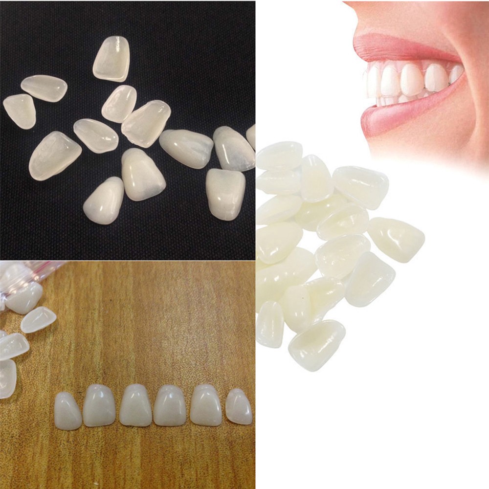 Teeth Whitening Veneers - 70 قطعة/عبوة قشور أسنان تجميلية لتبييض