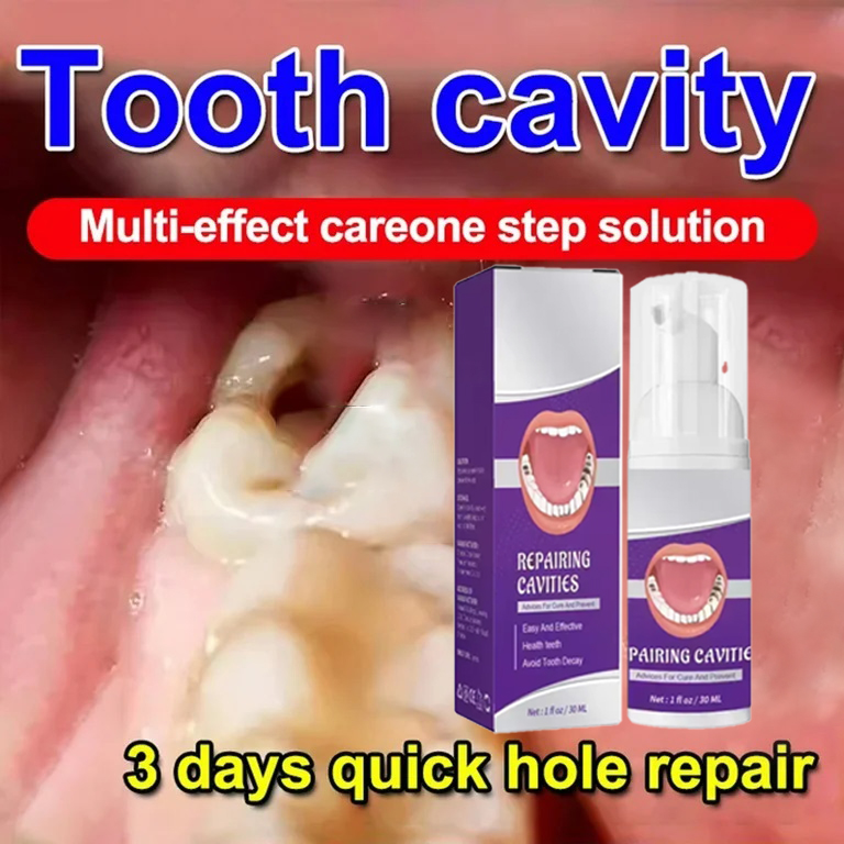 Teeth Whitening Best - معجون أسنان لتنظيف الأسنان يزيل بقع