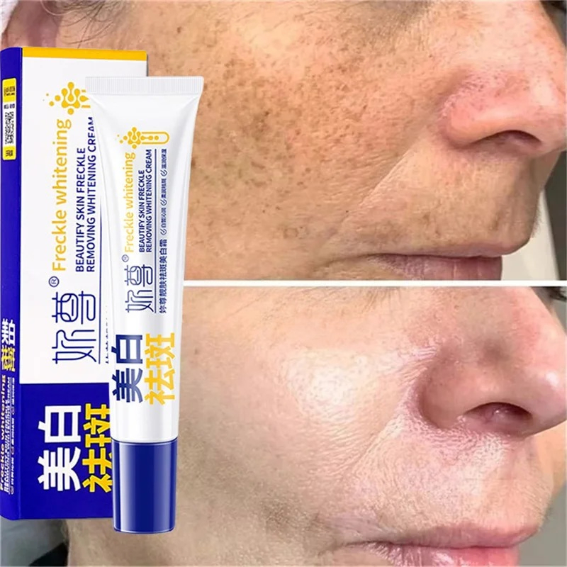كريم تبييض قوي لإزالة البقع يف - مراجعة Charcoal Whitening Paste وسعره