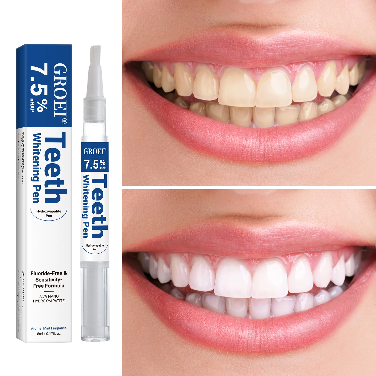 هيدروكسياباتيت تبييض الأسنان ا - مراجعة Teeth Whitening With Peroxide وسعره