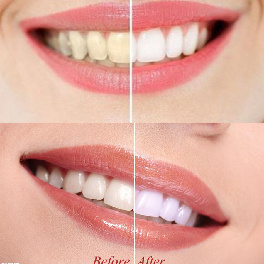 الخيزران الفحم الأسنان الأسنان - مراجعة Teeth Whitening Q&M وسعره