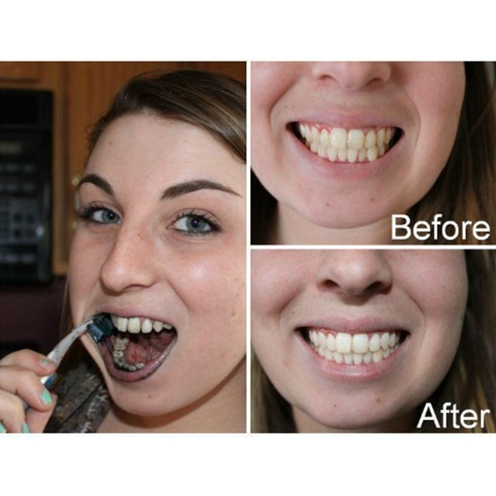 الخيزران الفحم الأسنان الأسنان - مراجعة Teeth Whitening Q&M وسعره
