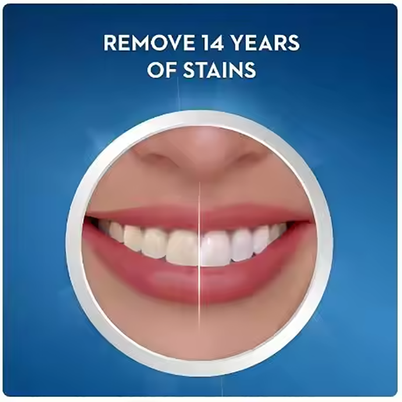 كريست الأبيض شرائط تبييض الأسن - مراجعة Teeth Whitening Kit At Home وسعره