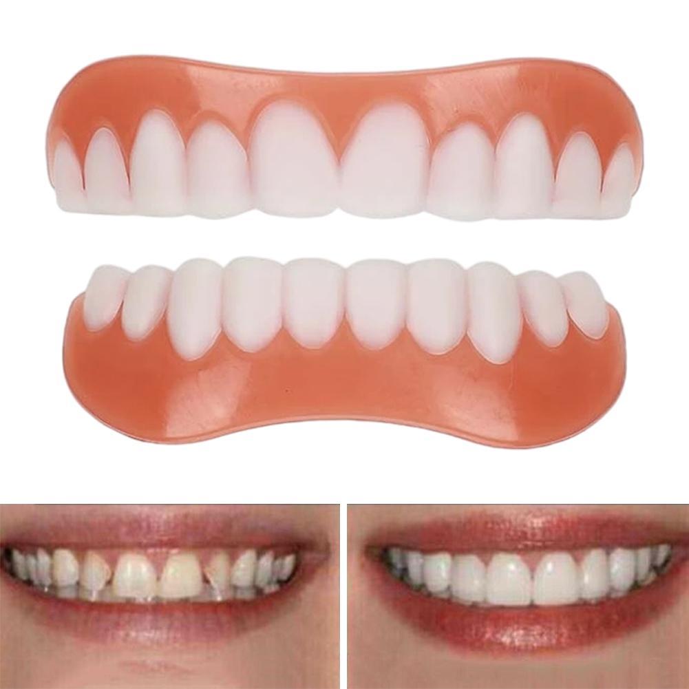 أسنان اصطناعية جديدة من السيلي - مراجعة Teeth Whitening Veneers وسعره