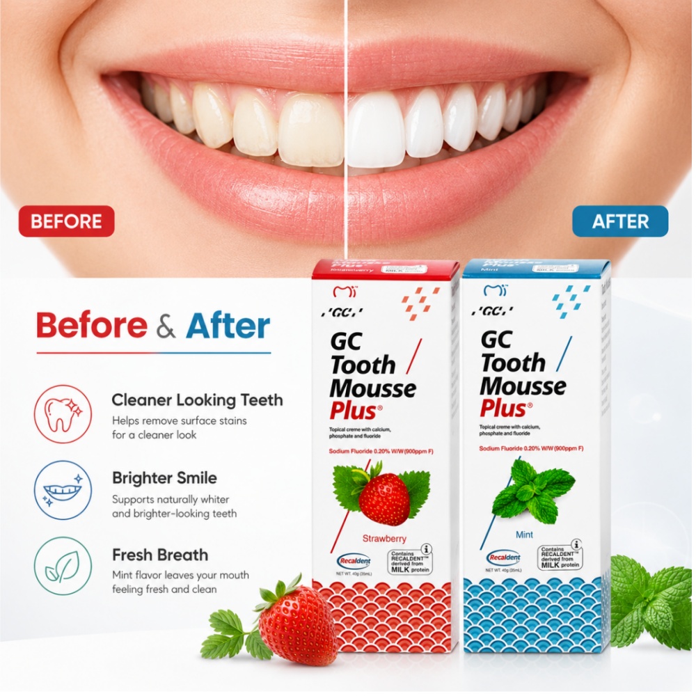 موس جي سي توث بلس بنكهة النعنا - مراجعة Teeth Whitening Best وسعره