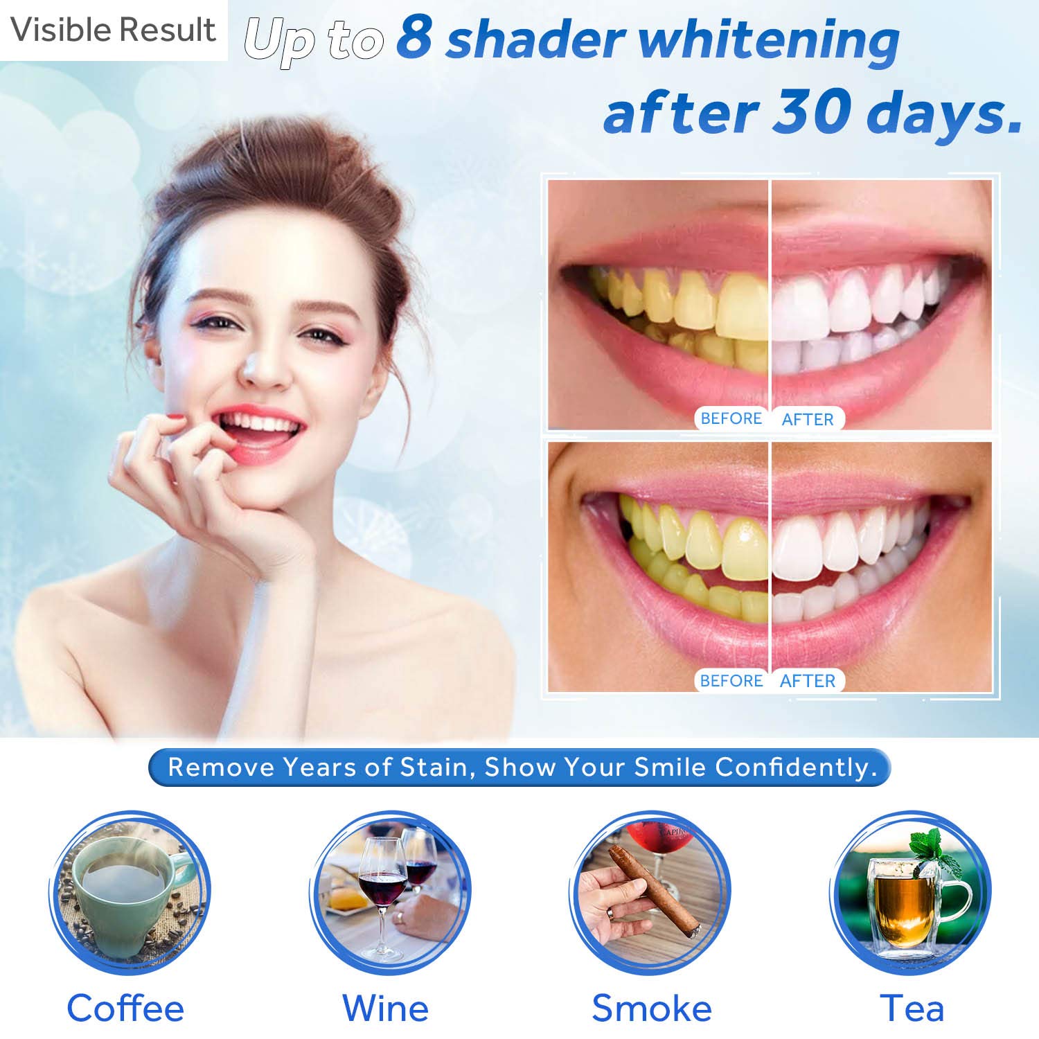 تبييض الأسنان جل الملء حقنة تب - مراجعة Teeth Whitening Q&M وسعره