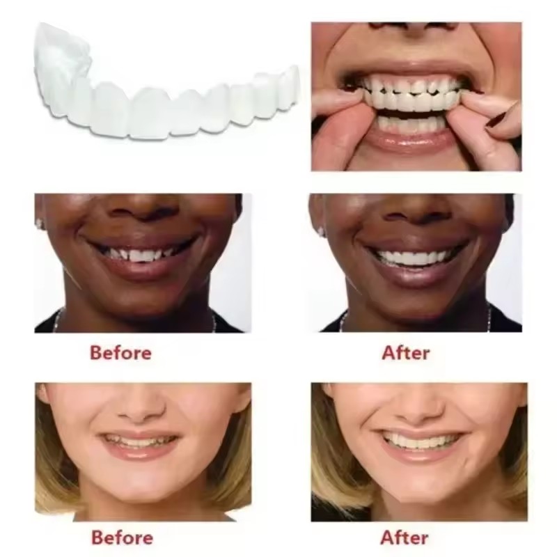 أطقم أسنان اصطناعية مؤقتة لتبي - مراجعة Teeth Whitening Veneers وسعره
