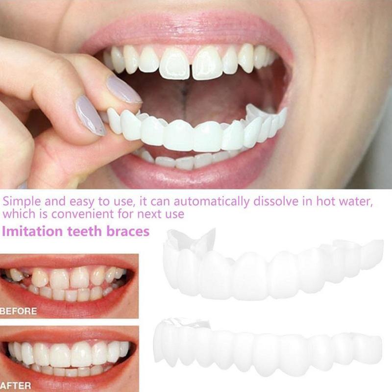 المفاجئة على قشور الأسنان سيلي - مراجعة Teeth Whitening Veneers وسعره