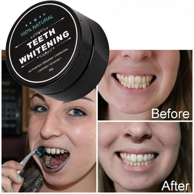 1 صندوق من مسحوق تبييض الأسنان - مراجعة Whitening Powder Activated وسعره