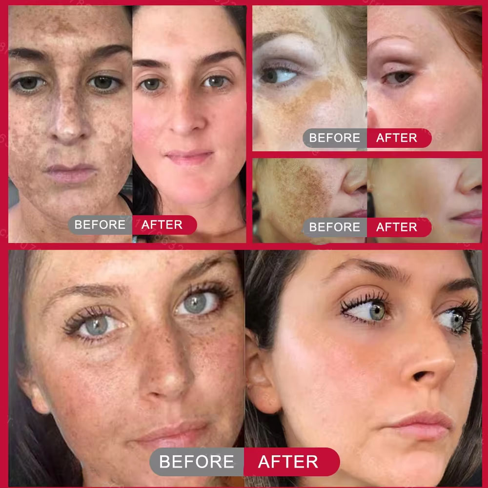 كريم تفتيح قوي لإزالة البقع، ي - مراجعة Charcoal Whitening Paste وسعره