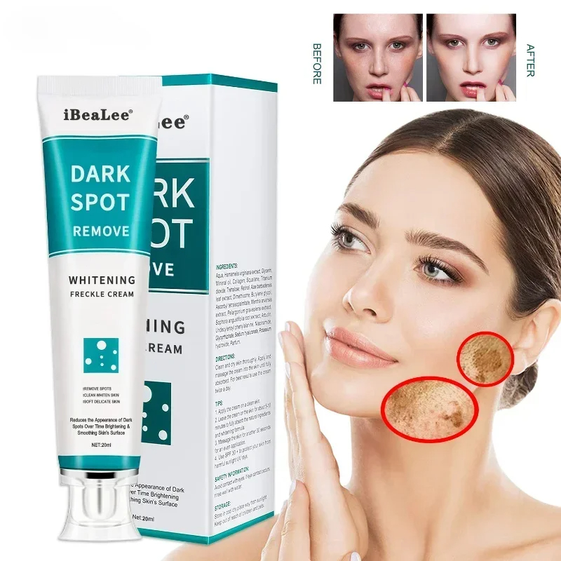 كريم تبييض البقع الداكنة النمش - مراجعة Charcoal Whitening Paste وسعره