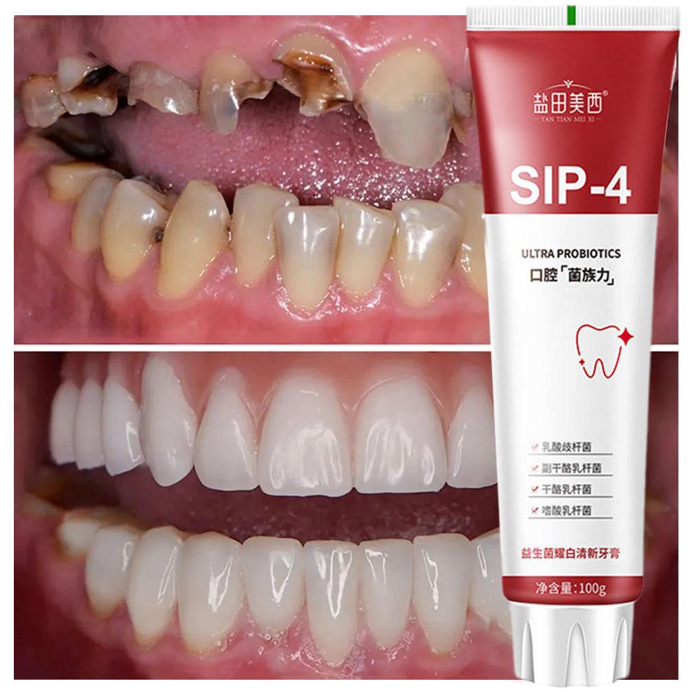 معجون أسنان بروبيوتيك سيب-4 لت - مراجعة Teeth Whitening Best وسعره