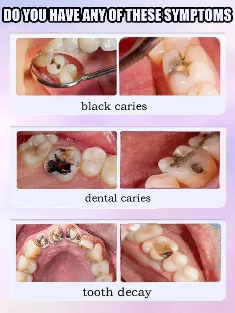 المبيعات الساخنة الأكثر مبيعًا - مراجعة Teeth Whitening Best وسعره