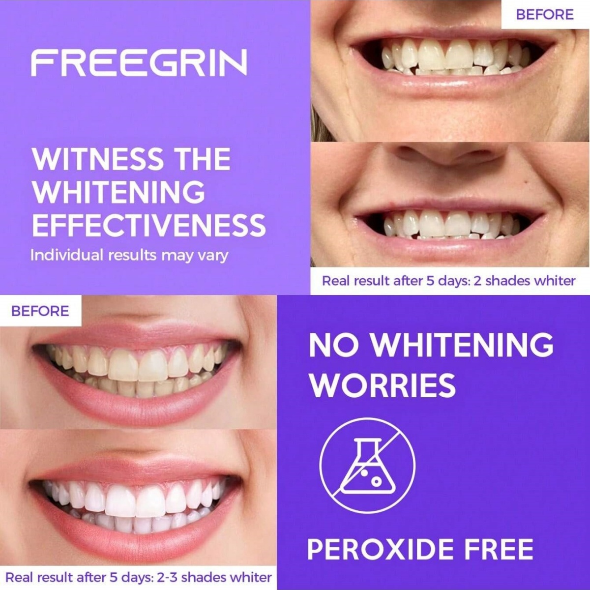 ديلوكس تبييض الأسنان ملصقات 7/ - مراجعة Teeth Whitening With Peroxide وسعره