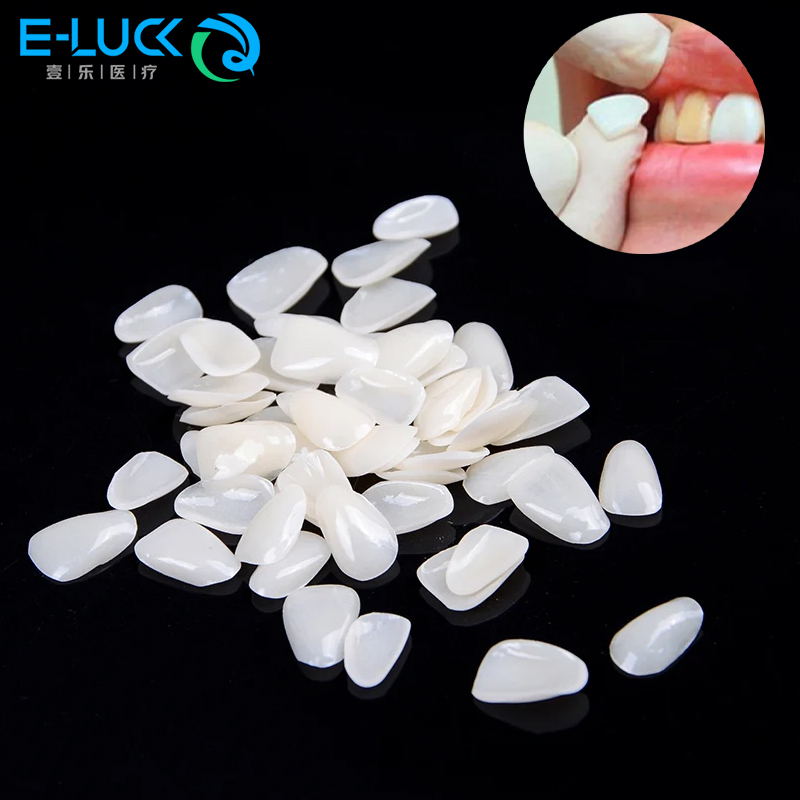 50 قطعة قشرة الأسنان تاج مؤقت  - مراجعة Teeth Whitening Veneers وسعره