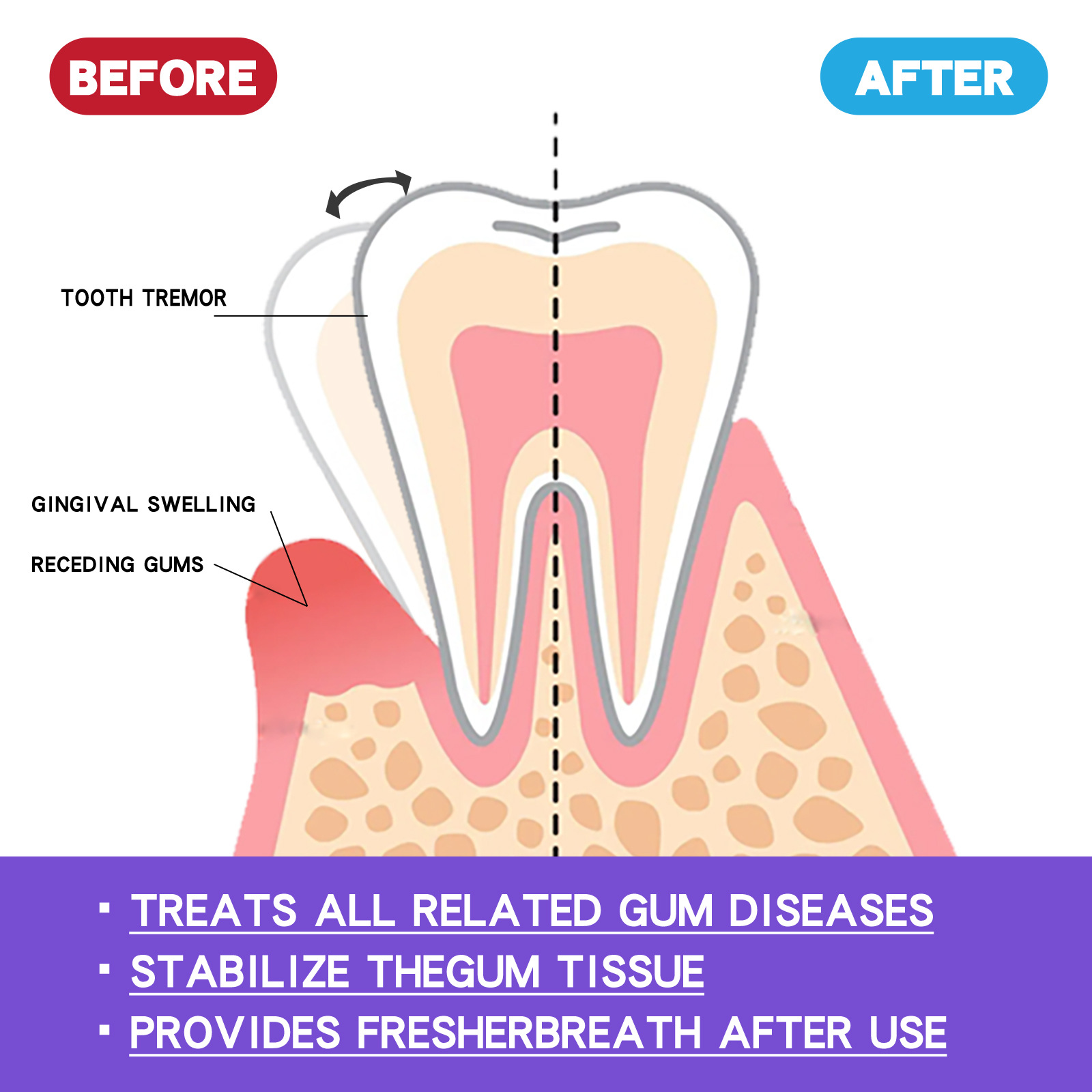 60 مللي موس تبييض الأسنان V34  - مراجعة Teeth Whitening Best وسعره