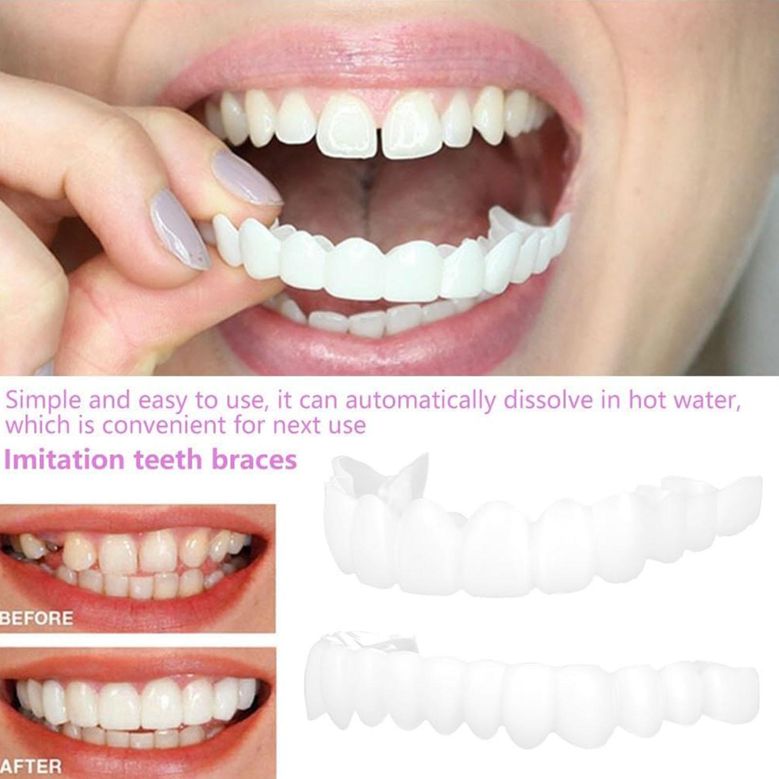 2 قطعة قشور الأسنان المؤقتة لل - مراجعة Teeth Whitening Veneers وسعره