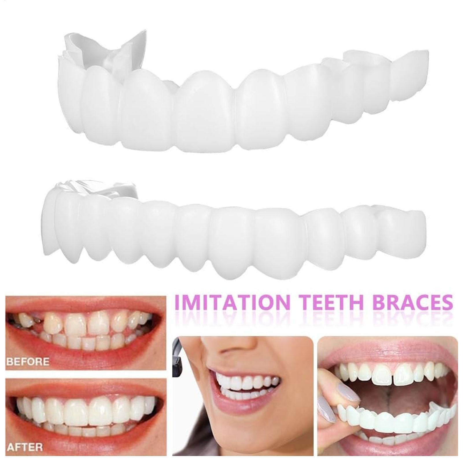 2 قطعة قشور الأسنان المؤقتة لل - مراجعة Teeth Whitening Veneers وسعره