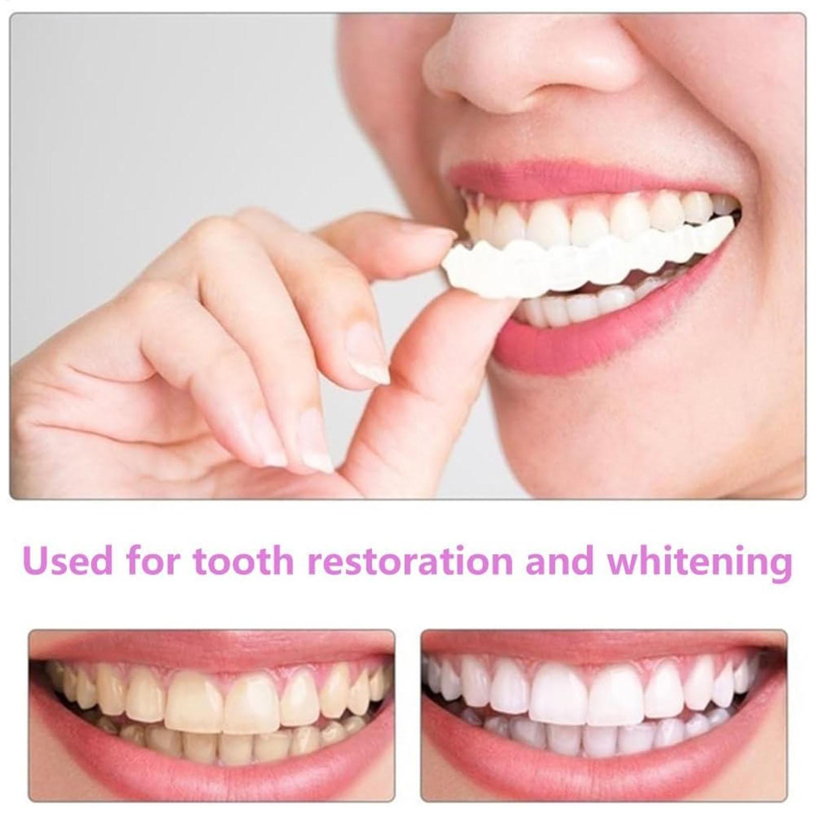 2 قطعة قشور الأسنان المؤقتة لل - مراجعة Teeth Whitening Veneers وسعره