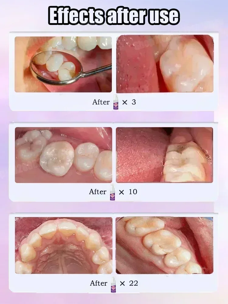 معجون أسنان لتنظيف الأسنان يزي - مراجعة Teeth Whitening Best وسعره